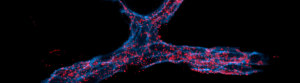 Nanoparticulas RNA interferencia
