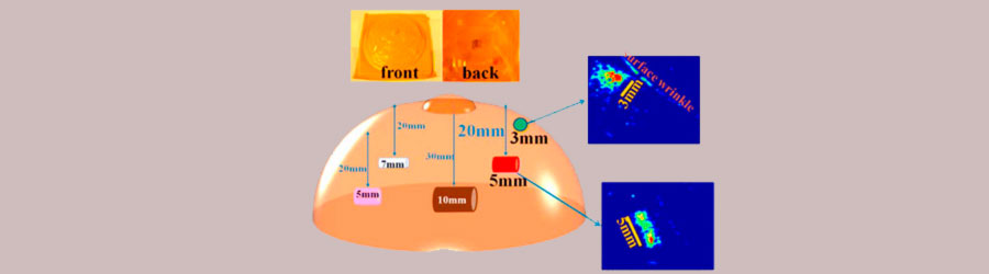 Nanofilm para detección de cáncer de mama