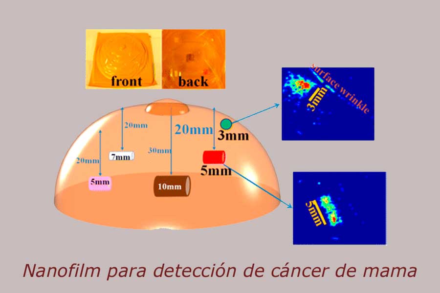 nanofilm para detección de cáncer de mama