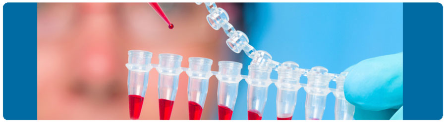Un análisis de sangre puede detectar el cáncer de ovario en el 86% de los casos