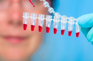 Análisis de sangre para cáncer de ovario