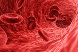 ADN tumoral circulante de cáncer de páncreas