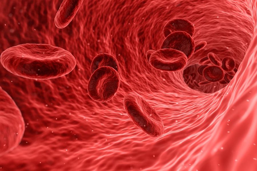El ADN tumoral circulante puede servir como marcador pronóstico en Cáncer de Páncreas
