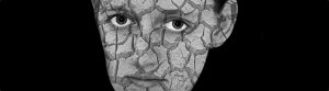 Melanoma o Queratosis Seborreica, cual es la diferencia?