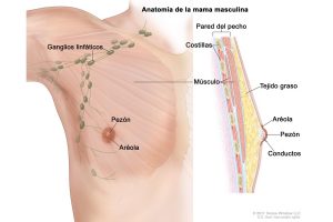 cáncer de mama masculino